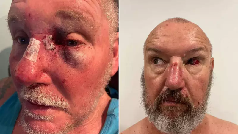 NSW Prison Officers Walk Out Over 'Slap on the Wrist' for Brutal Inmate Attack