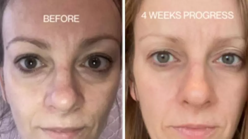 Edible Beauty's Black Friday Sale: Save 35% on Cult Skincare