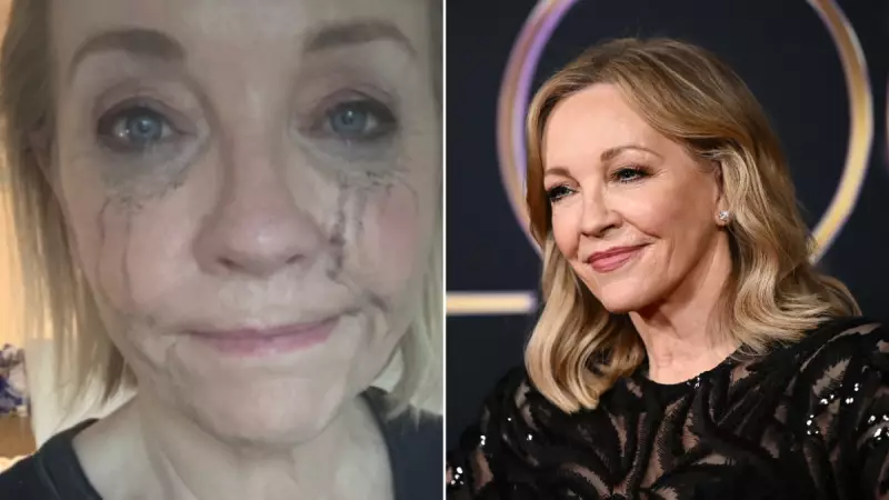 Rebecca Gibney Reveals Private Mental Health Battle After Anxiety Return