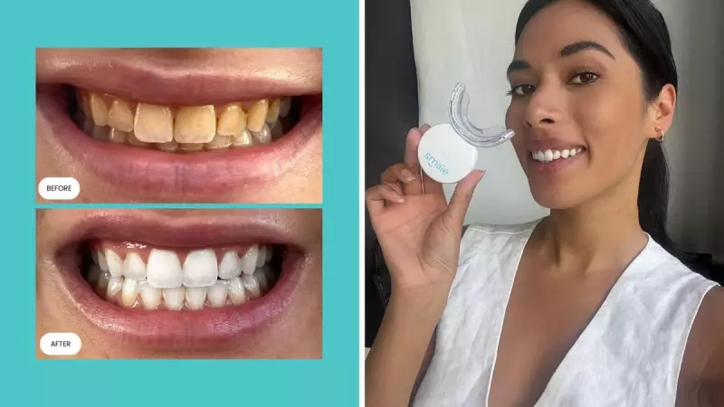 Smilie's Historic Black Friday Sale: $99 Teeth Whitening Bundle