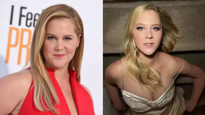 Amy Schumer Reveals 50lb Weight Loss Was to 'Survive' Cushing Syndrome