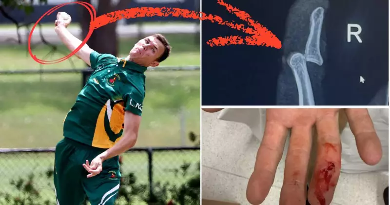 Cricketer's Finger Nearly 'Torn Off' in Gruesome On-Field Accident