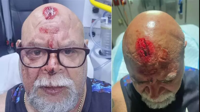 Fremantle Dockers Star's Father Traumatised After Aveley Coward Punch