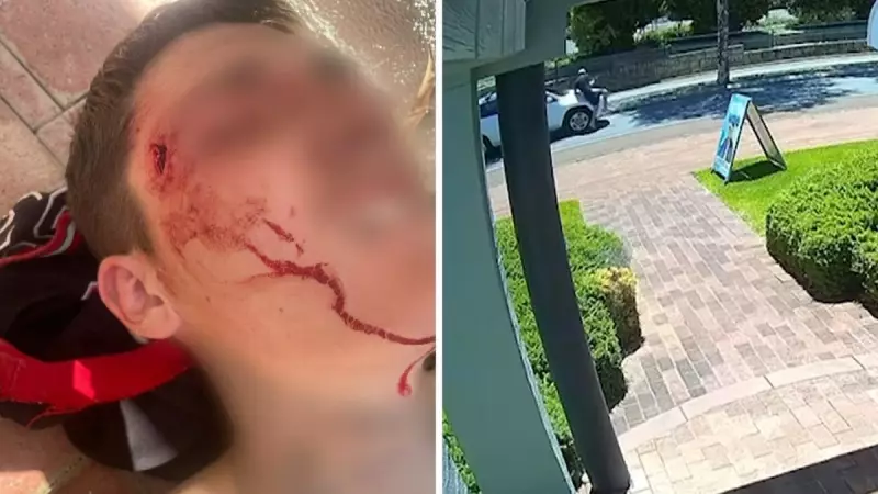 Teen hit by car on wrong side of road in Mandurah, driver flees