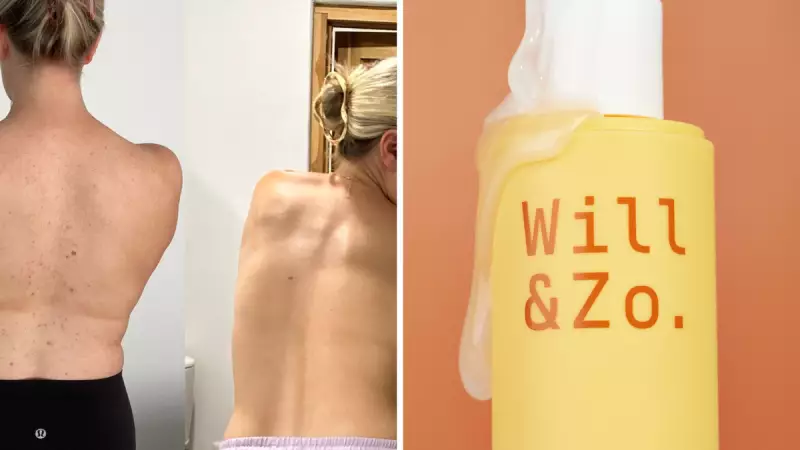 Will & Zo's Body Breakout Set: Aussie Duo Transforms Skincare Routines