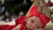 Australia's Most Premature Baby Defies Odds, Home for Christmas