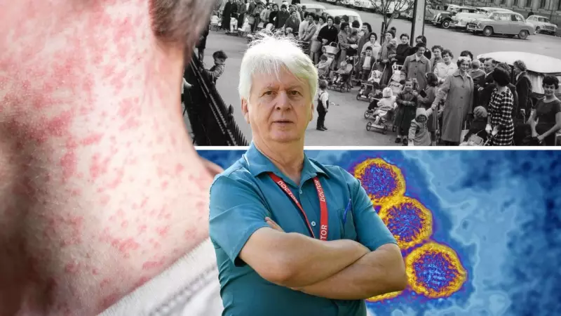 Alarming Surge in Measles and Melioidosis Hits North Queensland