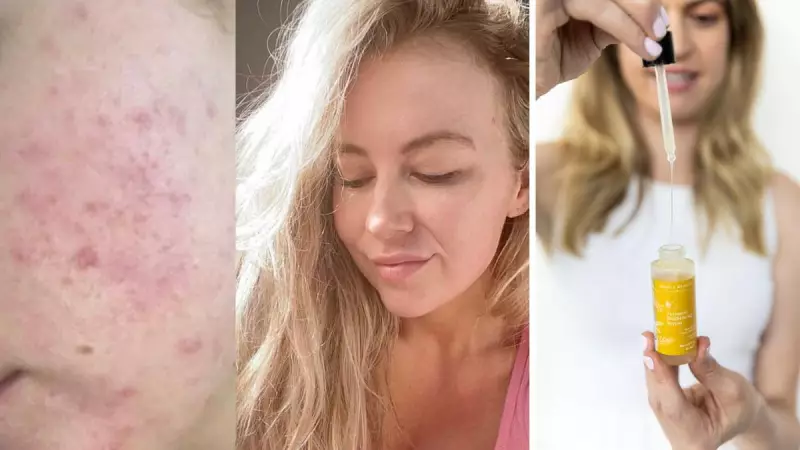 Australian Skincare's 'Soft Era': Turmeric Serum Offers Gentle Brightening