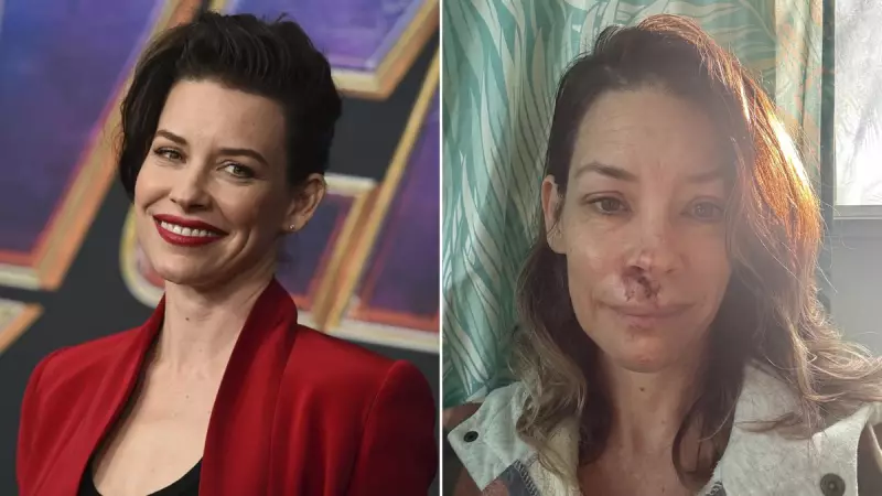 Evangeline Lilly Reveals Brain Damage After Freak Beach Accident