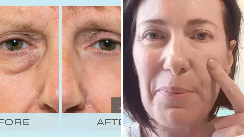 My Perfect Eyes: The Cult-Favourite Eye Cream Taking the Beauty World by Storm