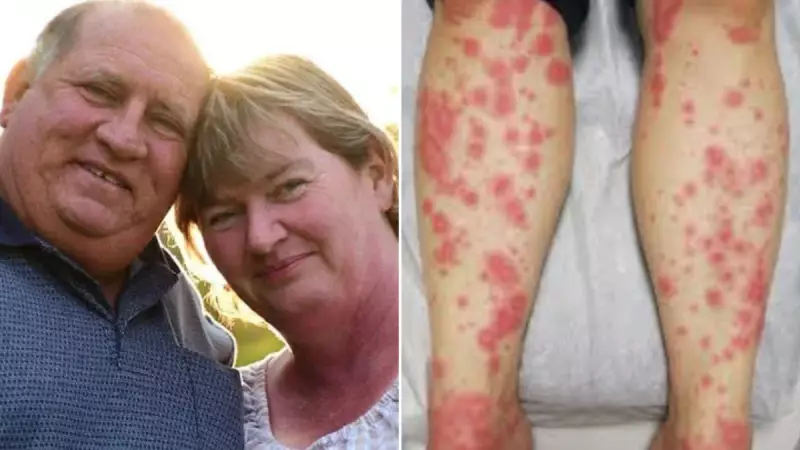 NSW Mother-of-10 Airlifted to ICU After Rare Antibiotic Reaction