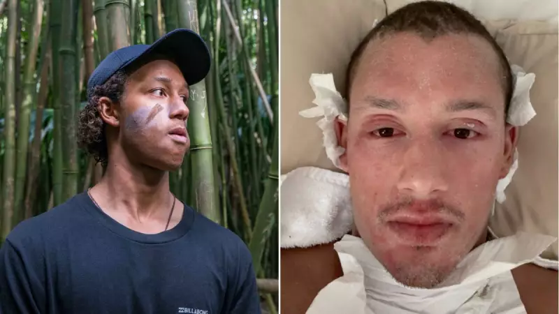 Perth Man's Steroid Cream Nightmare Reveals Medical Knowledge Gaps