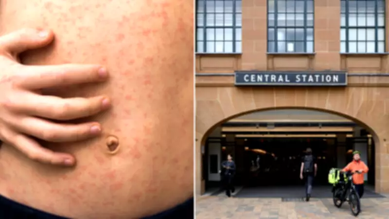 Sydney Measles Alert: Travellers Return with Infection Risk