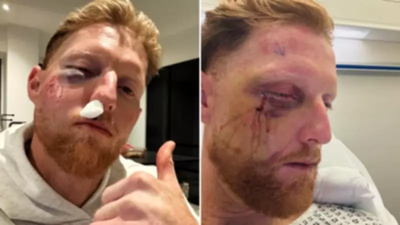 England Cricket Captain Ben Stokes Undergoes Surgery After Training Incident