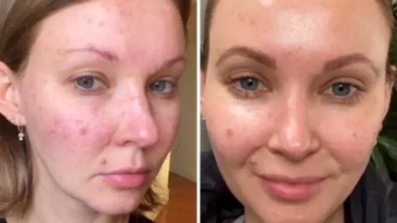 French Skincare Secret: Clemence Organics Face Cream Sells Out on Amazon Australia