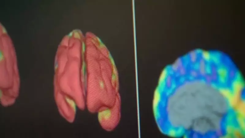 Gold Coast Grandmother's Remarkable Alzheimer's Recovery with New Drug