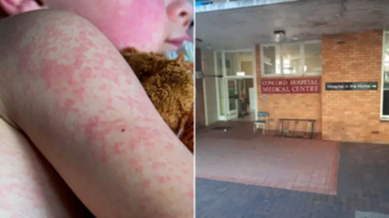 Measles Alert in Sydney's Inner West After Two New Cases Linked to Overseas Traveller