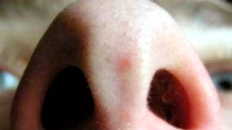 Mystery Odour Investigation Launched Across Geelong and Surf Coast