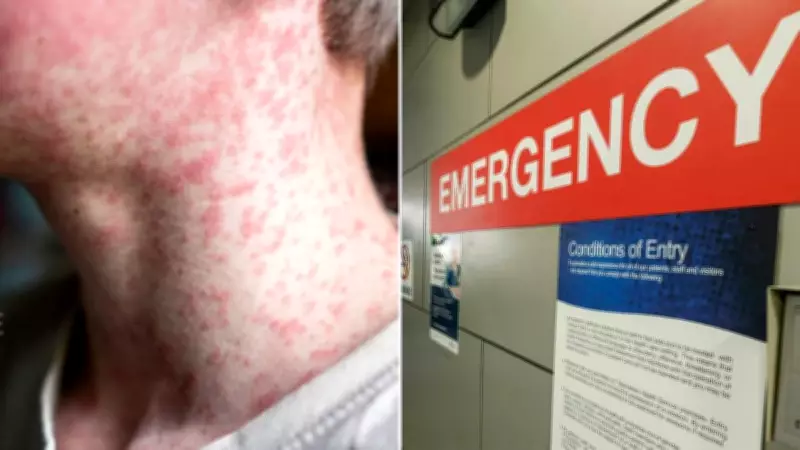 NSW Health Issues Measles Alert After Four New Cases Detected Across the State