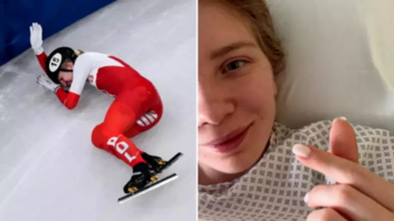 Polish Speedskater Kamila Sellier Shares Update After Face Injury Surgery