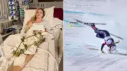 Lindsey Vonn Undergoes Third Surgery After Olympic Downhill Crash