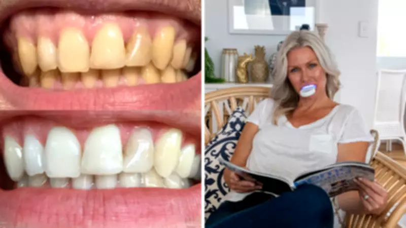 Affordable Teeth Whitening Kit Takes Australia by Storm with Half-Price Deal