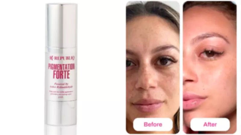 Australian Skincare Brand Launches Post-Summer Pigmentation Treatment with Retinaldehyde