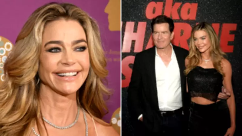 Denise Richards Opens Up About Recent Facelift and Cosmetic Procedures