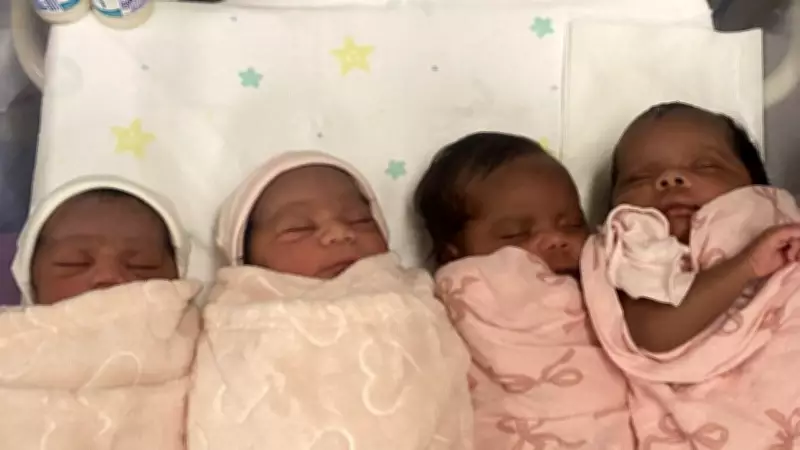 Double Twins Phenomenon: Doomadgee Sisters' Viral Birth Story