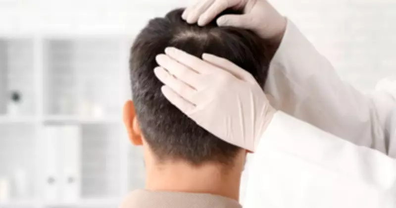Hairline Planning in Hair Transplants: Key Insights on Symmetry and Clinical Assessment