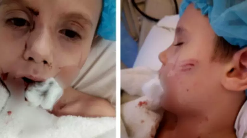 Hero Tradesmen Save Young Boy from Savage Dog Attack in Cairns