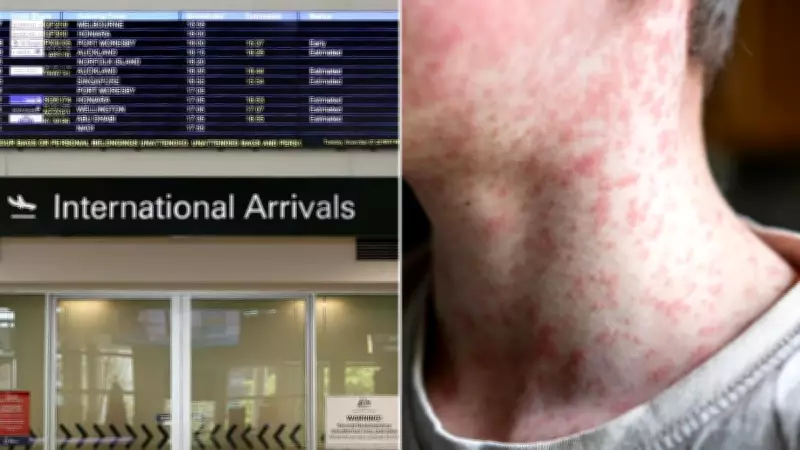 Measles Alert at Brisbane Airport After Infectious Cases Pass Through Terminal