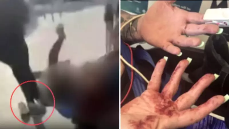 Mother Admits to Kicking Another Parent in Head During Violent Brawl Over Bullying