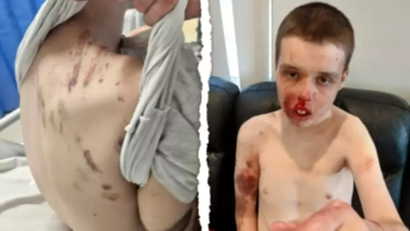 Perth Family Demands Answers After NDIS Assault Leaves Autistic Man Without Care
