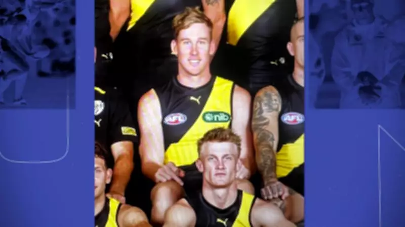 Richmond's Tom Lynch Reveals Why His Fused Finger Was Edited Out of Team Photos