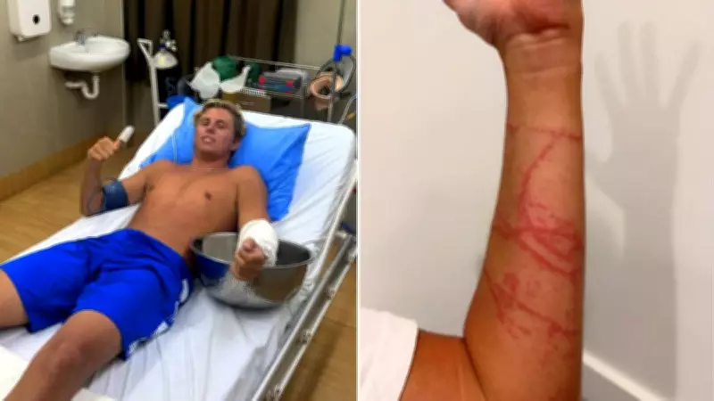 Australian Surfer Hospitalised After Box Jellyfish Sting at Fiji's Cloudbreak