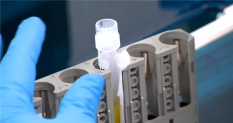 Australian Trial Combines Blood and Online Tests for Early Alzheimer's Detection