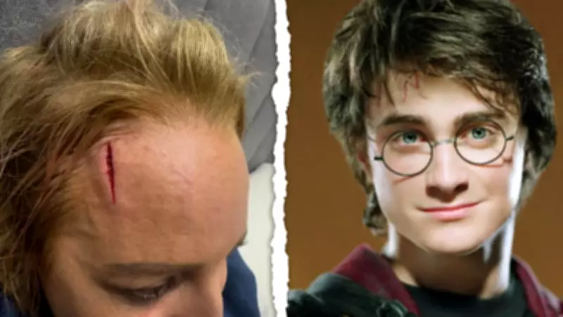 Carrie Bickmore's Forehead Injury Sparks 'Carrie Potter' Nickname from Fans