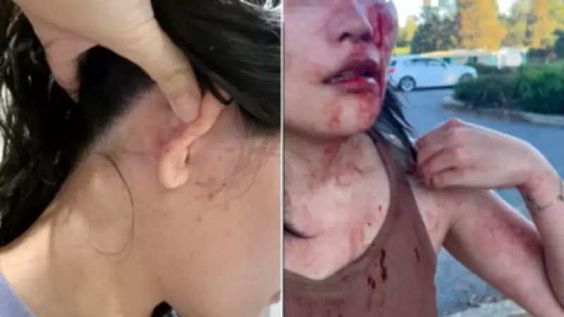 Chinese Embassy Demands Justice After Racist Assault in Canberra