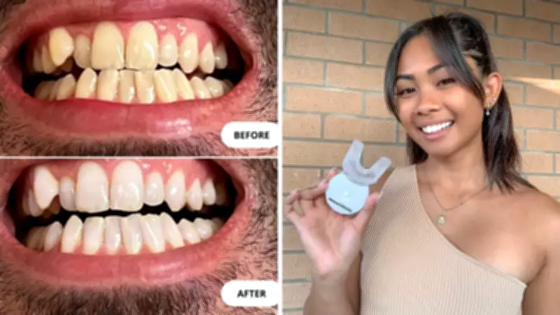 Glow Up Parties Sweep Australia with At-Home Teeth Whitening Sales