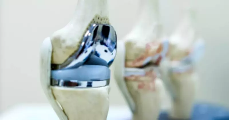 Knee Replacement Recovery: What to Expect and How Long It Really Takes