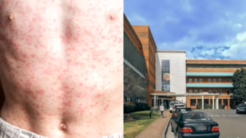 Measles Alert in Sydney After Infected Traveller Returns from Japan