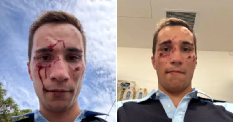 Police Officer Hospitalised After Alleged Attack During Roadside Test in Hunter Valley