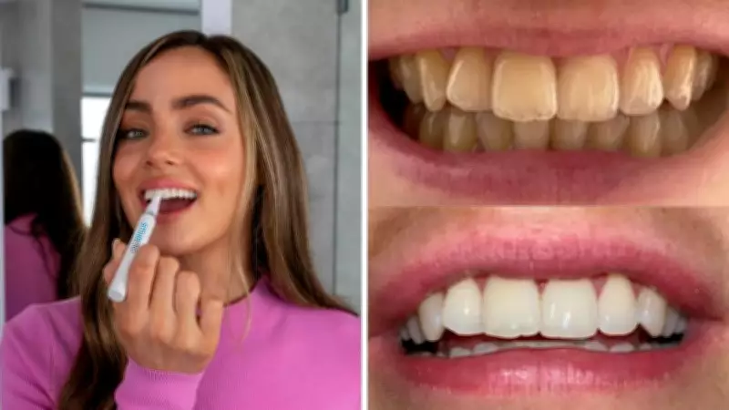 SmilePro Whitening Kit Hits Chemist Warehouse with 50% Off Launch Offer