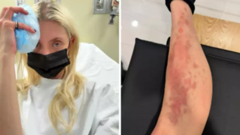 Taylor Momsen Bitten by Spider on AC/DC Tour in Mexico, Shares Hospital Ordeal