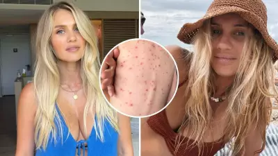 Elyse Knowles Faces Backlash Over Naked Photo of Daughter with Chicken Pox