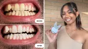 Glow Up Parties Sweep Australia with At-Home Teeth Whitening Sales