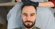 Turkey's Hair Transplant Clinics Formalise Hairline Symmetry Benchmarks in Treatment Planning
