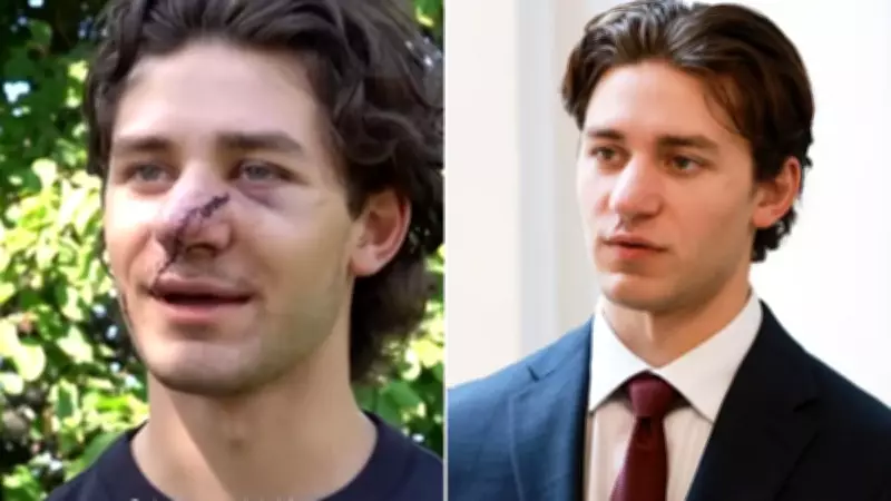 American Tourist Confronts Attackers in German Court Over Box Cutter Slashing