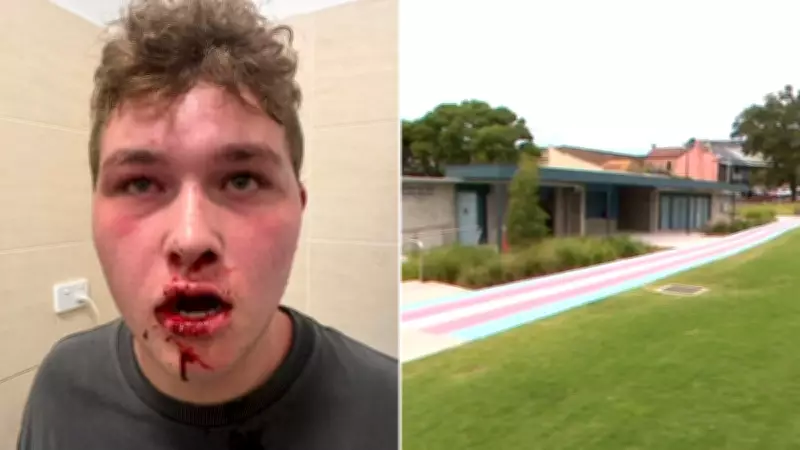 Autistic teen bashed by youths in Sydney park while trying to make friends